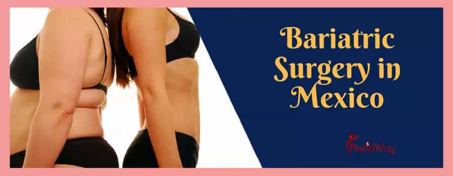 Safest Weight Loss Surgery in Mexico